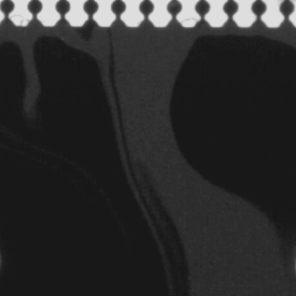 Black regions show particles jamming in a microfluidic device