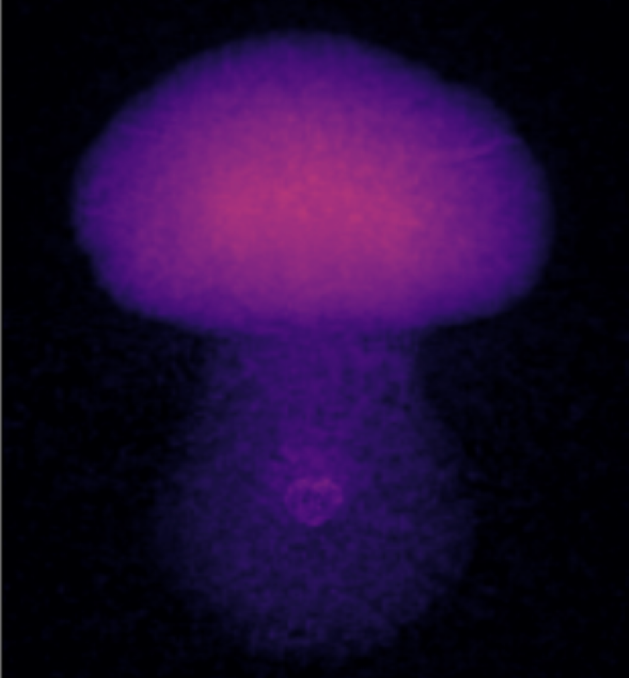 Fracture grows across two gelatin layers